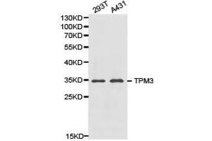 Western Blotting (WB) image for anti-Tropomyosin 3 (TPM3) antibody (ABIN1875182) (TPM3 anticorps)