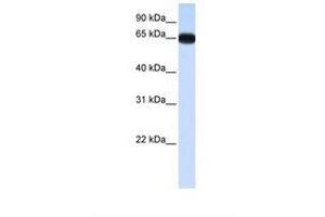 Image no. 1 for anti-Distal-Less Homeobox 4 (DLX4) (AA 38-87) antibody (ABIN6737752) (DLX4 anticorps  (AA 38-87))
