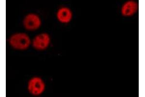ABIN6274305 staining Hela cells by IF/ICC. (SSBP2 anticorps  (N-Term))