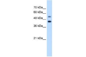 WB Suggested Anti-GTPBP2 Antibody Titration:  1. (GTPBP2 anticorps  (C-Term))