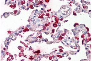 Image no. 2 for anti-Surfactant Protein B (SFTPB) (AA 194-243) antibody (ABIN1493901)