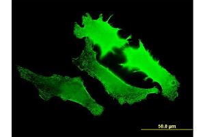 Immunofluorescence of monoclonal antibody to GUCY2D on HeLa cell. (GUCY2D anticorps  (AA 521-630))