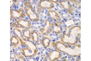 Immunohistochemistry of paraffin-embedded Mouse kidney using UGDH Polyclonal Antibody at dilution of 1:100 (40x lens). (UGDH anticorps)