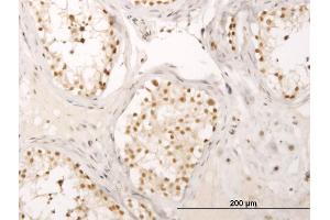 Immunoperoxidase of monoclonal antibody to CRSP6 on formalin-fixed paraffin-embedded human testis. (MED17 anticorps  (AA 551-651))