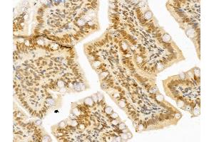 ABIN6264519 and ABIN6273013 at 1/100 staining Rat colon tissue by IHC-P.