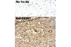 anti-Epidermal Growth Factor Receptor (EGFR) (C-Term) antibody