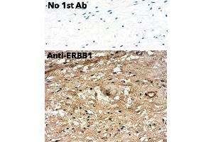 Immunohistochemistry (IHC) image for anti-Epidermal Growth Factor Receptor (EGFR) (C-Term) antibody (ABIN6254171)