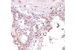 IHC analysis of Acid Phosphatase/ACP5 using anti-Acid Phosphatase/ACP5 antibody (ABIN7601574). (ACP5 anticorps  (AA 39-325))