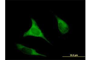 Immunofluorescence of purified MaxPab antibody to EIF2B3 on HeLa cell.