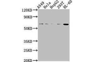 Western Blot Positive WB detected in: A549 whole cell lysate, Hela whole cell lysate, HepG2 whole cell lysate, 293T whole cell lysate, HL60 whole cell lysate All lanes: MDM2 antibody at 1:2000 Secondary Goat polyclonal to rabbit IgG at 1/50000 dilution Predicted band size: 56, 34, 31, 25, 36, 15, 12, 49, 50 kDa Observed band size: 56 kDa