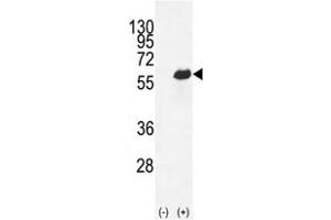 Western blot analysis of Osteopontin antibody and 293 cell lysate (2 ug/lane) either nontransfected (Lane 1) or transiently transfected (2) with the OPN-a/b gene.