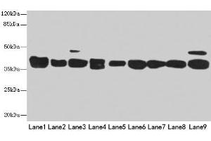Western blot All lanes: DNAJB1 antibody at 3 μg/mL Lane 1: Mouse spleen tissue Lane 2: Colo320 whole cell lysate Lane 3: Hela whole cell lysate Lane 4: LO2 whole cell lysate Lane 5: HepG2 whole cell lysate Lane 6: HT29 whole cell lysate Lane 7: A549 whole cell lysate Lane 8: Jurkat whole cell lysate Lane 9: MCF-7 whole cell lysate Secondary Goat polyclonal to rabbit IgG at 1/10000 dilution Predicted band size: 39, 28 kDa Observed band size: 39 kDa