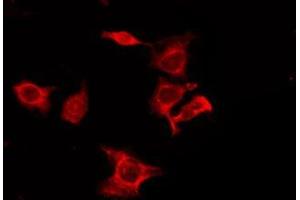 ABIN6275980 staining 293T by IF/ICC.