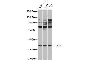 Western blot analysis of extracts of various cell lines, using GNT antibody  at 1:1000 dilution. (A4GNT anticorps  (AA 1-340))