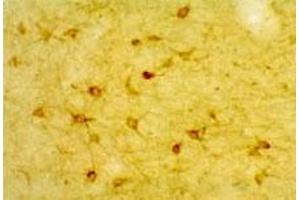 Low magnification IHC image of neurons in rat cortex. (HTR2A anticorps  (AA 22-41))