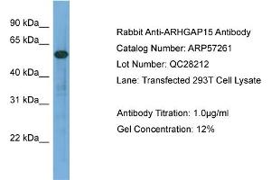 WB Suggested Anti-ARHGAP15  Antibody Titration: 0. (ARHGAP15 anticorps  (Middle Region))