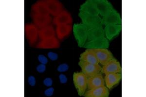 ABIN6258145 and ABIN6273917 staining Hela cells(30 min of UV treatment) by IF/ICC. (S1PR5 anticorps  (C-Term))