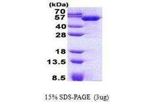 Figure annotation denotes ug of protein loaded and % gel used. (TBCEL Protéine)