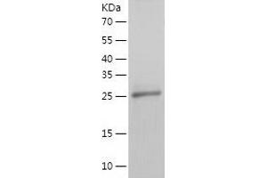 Western Blotting (WB) image for MHC Class I Polypeptide-Related Sequence A (MICA) (AA 24-306) protein (His-IF2DI Tag) (ABIN7123952)