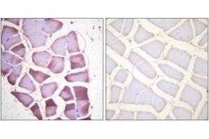 Immunohistochemistry analysis of paraffin-embedded human skeletal muscle, using S6 Ribosomal Protein (Phospho-Ser240) Antibody.