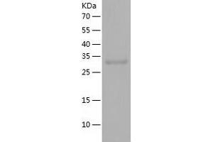 Western Blotting (WB) image for Ubiquitin-Like Domain Containing CTD Phosphatase 1 (UBLCP1) (AA 1-318) protein (His tag) (ABIN7125640)