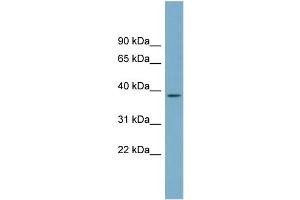 WB Suggested Anti-SDSL Antibody Titration:  0. (SDSL anticorps  (N-Term))