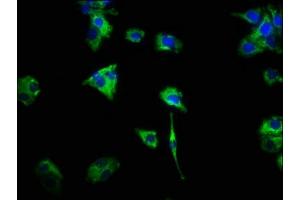Immunofluorescence staining of HepG2 cells with ABIN7154406 at 1:466, counter-stained with DAPI. (CSF2RA anticorps  (AA 23-320))