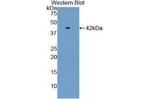Detection of Recombinant VTCN1, Human using Polyclonal Antibody to V-Set Domain Containing T-Cell Activation Inhibitor 1 (VTCN1)