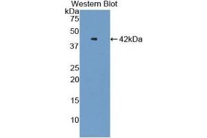 Detection of Recombinant VTCN1, Human using Polyclonal Antibody to V-Set Domain Containing T-Cell Activation Inhibitor 1 (VTCN1) (VTCN1 anticorps  (AA 153-241))