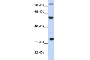 WB Suggested Anti-APOBEC1 Antibody Titration:  0.