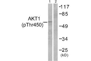 Western blot analysis of extracts from NIH/3T3 cells, treated with PDGF (50ng/ml, 20mins), using Akt (Phospho-Thr450) antibody. (AKT1 anticorps  (pThr450))