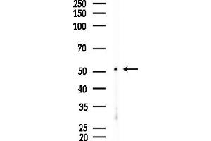anti-Calreticulin 3 (CALR3) (C-Term) antibody