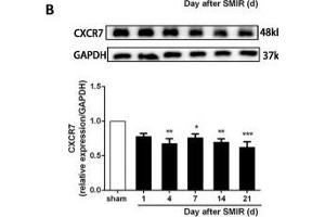 The CXCR7 and PI3K/Akt signaling pathways are involved in CPSP in the dorsal horn of the spinal cord. (GAPDH anticorps)