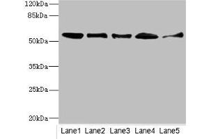 Western blot All lanes: GLYCTKantibody at 5. (GLYCTK anticorps  (AA 284-523))