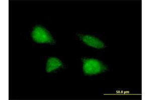 Immunofluorescence of purified MaxPab antibody to C19orf43 on HeLa cell. (C19orf43 anticorps  (AA 1-176))
