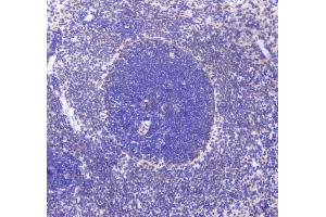 IHC analysis of CD80 using anti-CD80 antibody .