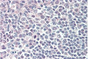 Image no. 2 for anti-Interferon Regulatory Factor 8 (IRF8) antibody (ABIN5868811) (IRF8 anticorps)