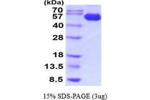 SDS-PAGE (SDS) image for Tumor Necrosis Factor Receptor Superfamily, Member 9 (TNFRSF9) (AA 18-186) (Active) protein (hIgG-His-tag) (ABIN7529311)