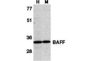 Western Blotting (WB) image for anti-Tumor Necrosis Factor (Ligand) Superfamily, Member 13b (TNFSF13B) (C-Term) antibody (ABIN1030279) (BAFF anticorps  (C-Term))