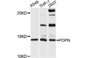 Western blot analysis of extracts of various cell lines, using PDPN antibody (ABIN5974310) at 1/1000 dilution. (Podoplanin anticorps)