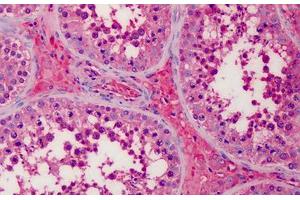 Human Testis, Leydig Cells: Formalin-Fixed, Paraffin-Embedded (FFPE) (APOA2 anticorps)