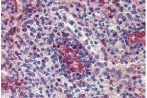 Spleen, Human: Formalin-Fixed, Paraffin-Embedded (FFPE)