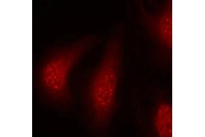Immunofluorescence staining of methanol-fixed Hela cells using p90RSK(Phospho-Thr348) Antibody. (RPS6KA1 anticorps  (pThr348))