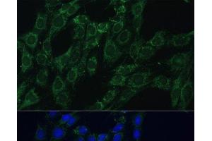 Immunofluorescence analysis of C6 cells using AEBP1 Polyclonal Antibody at dilution of 1:100 (40x lens).