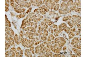 Image no. 1 for anti-Centromere Protein J (CENPJ) (AA 979-1089) antibody (ABIN599271) (CENPJ anticorps  (AA 979-1089))