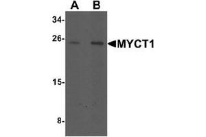 Western blot analysis of MYCT1 in rat lung tissue lysate with MYCT1 antibody at (A) 1 and (B) 2 ug/mL.