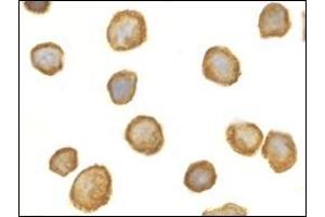 Immunocytochemistry of TOLLIP in THP-1 cells with AP30928PU-N TOLLIP antibody at 2 μg/ml. (TOLLIP anticorps  (Center))