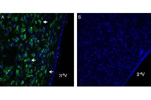 Expression of Orai1 in rat hypothalamus.