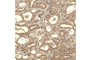 IHC analysis of TST using anti-TST antibody (ABIN7599105). (TST anticorps  (AA 1-220))