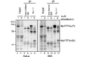 Western Blotting (WB) image for anti-Activating Transcription Factor 6 (ATF6) (N-Term) antibody (ABIN2451924) (ATF6 anticorps  (N-Term))